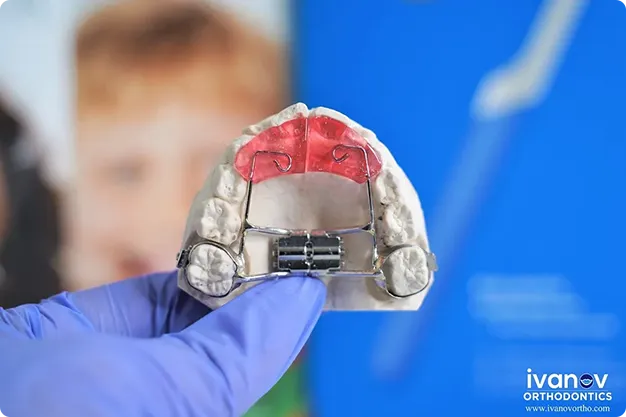 palate expander kids