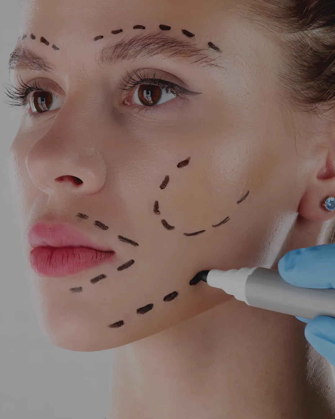 plastic surgeon in noida